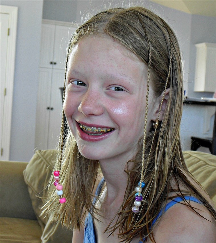 サラ Pennington, a teen who suffers from trichotillomania, a hair pulling disorder.