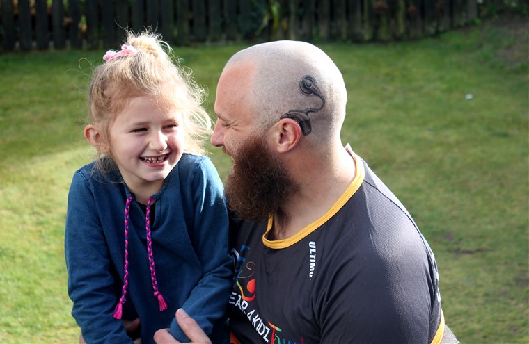 Papà's cochlear implant tattoo matches the real one worn by daughter.