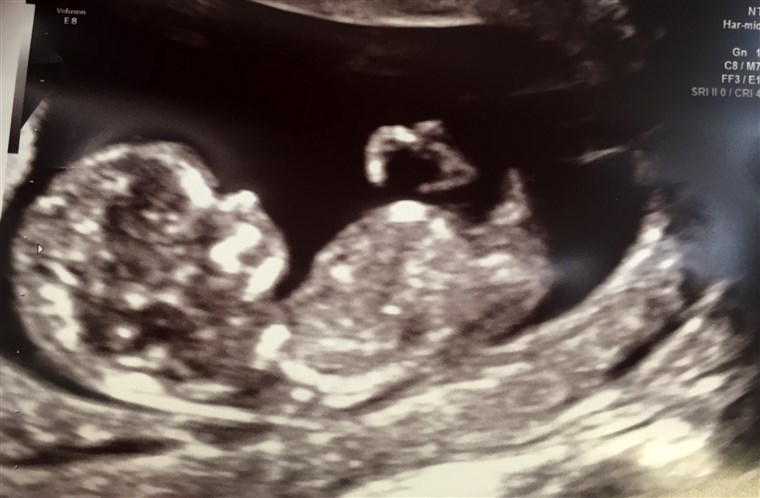 딜란 Dreyer announces she is pregnant with a baby boy
