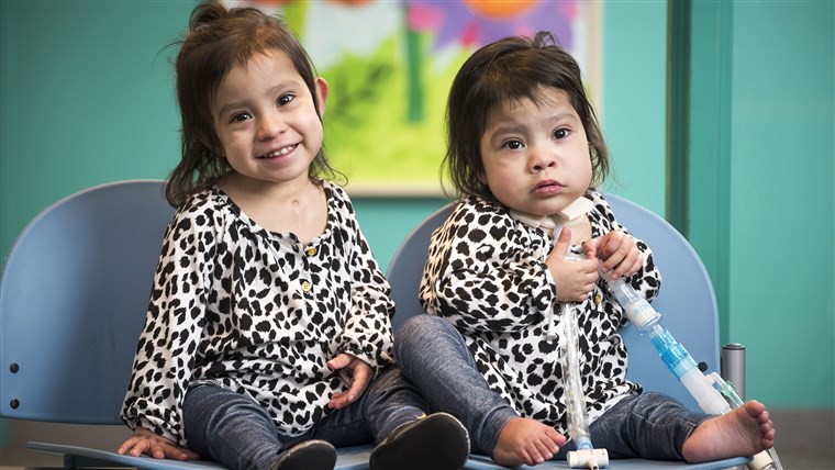 전에 conjoined twins Knatalye Hope and Adeline Faith Mata visiting Texas Children’s a few weeks before the one year anniversary of their historic separation surgery.