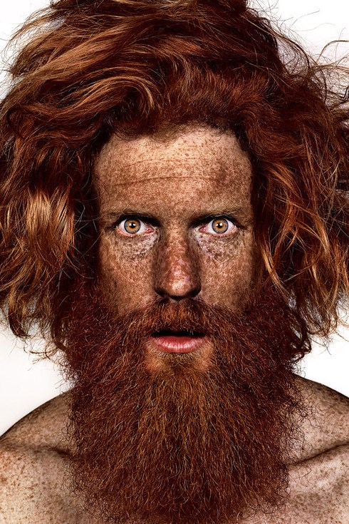 ショーン Conway participates in photographer Brock Elbank's #Freckles series.