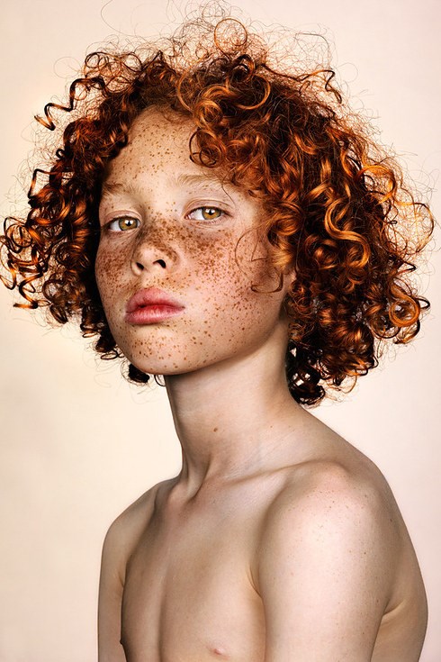 Per his #Freckles series, photographer Brock Elbank states he's received hundreds of emails from applicants of 