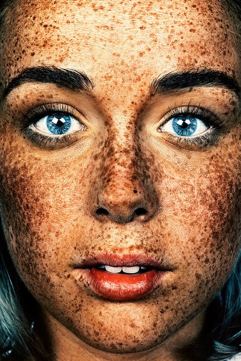 Il #Freckles series began as a single image taken in 2012 by photographer Brock Elbank.