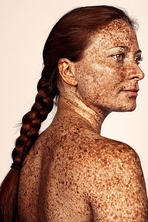 イギリス人 photographer Brock Elbank has gone viral with his #Freckles series.