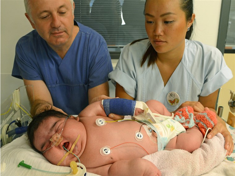컨설턴트 physician Matthias Knuepfer and nurse My take care of Germany's heaviest newborn until now at the neonatal intensive care ward of the Unive...