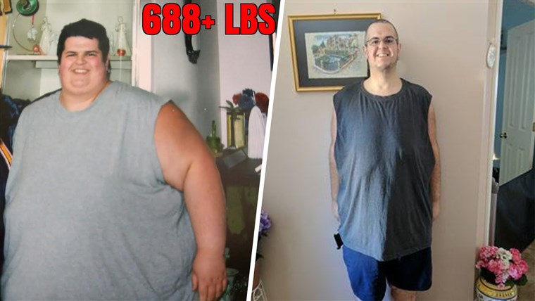 후 losing 374 pounds, Sal Paradiso has about 80 pounds of excess skin that needs to be removed. 