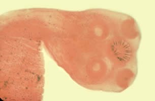 타 니아 saginata -- Scoleces of Taenia spp. The scolex of T. solium contains four large suckers and a rostellum containing two rows of large and small ...