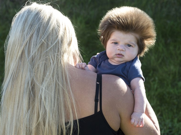 Ini baby has a huge head of hair