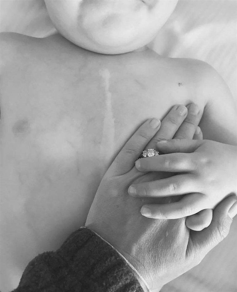 に one of the touching posts Blumenthal uploaded to Facebook, she reflects on Finn's scar from his initial open heart surgery.