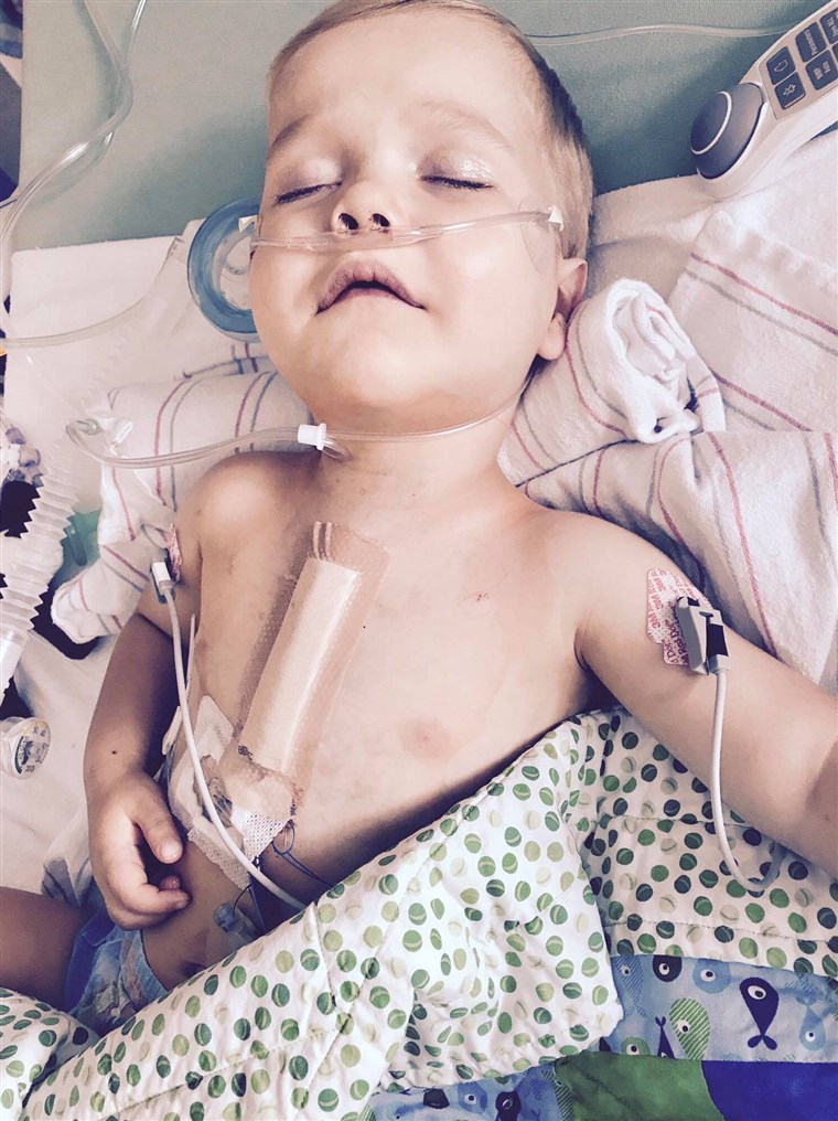 에서 his short life, Finn Blumenthal has had 14 procedures, 12 surgeries, and 2 open heart surgeries.