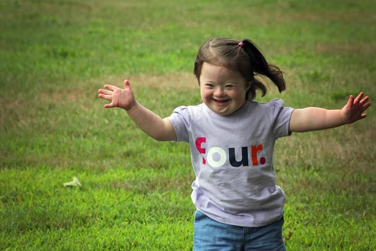 사진 작가 Laura Kilgus captured children with Down syndrome in a photo series