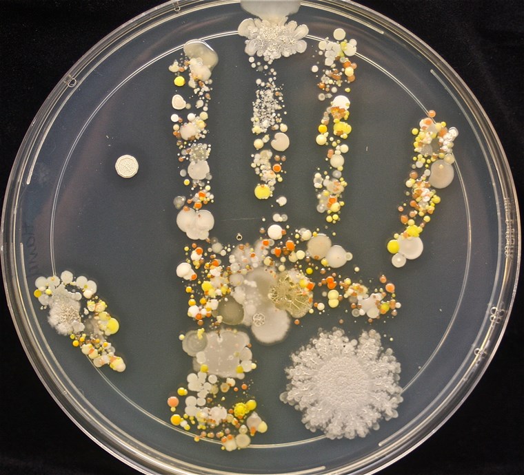 ザ 8-year-old boy had been playing outside before he pressed his hand into the Petri dish.