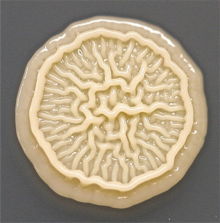 この is a close-up of a mystery circle in the upper left corner of the Petri dish. Tasha Sturm believes it's a contaminant.