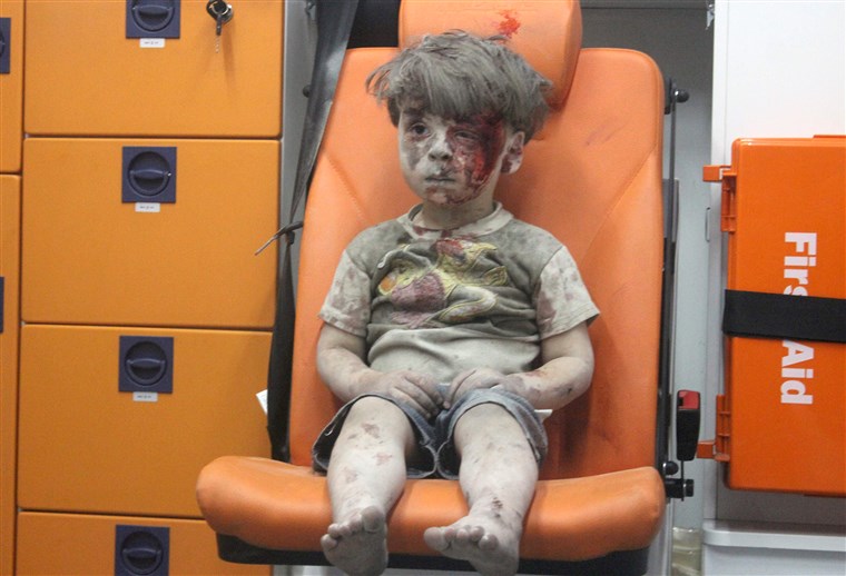 옴론, a four-year-old Syrian boy