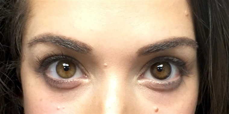 Bisa you spot the difference? My left eye is natural while my right eye is wearing the limbal ring-enhancing contact lens.